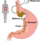 Business 2 image ADVANCED HYPNOSIS CENTRE Dieting & Weight Control in Glasgow La