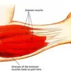 Business 3 image ADVANCED PHYSIOTHERAPY SERVICES Sports Medicine in Glasgow Glg
