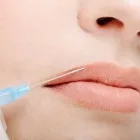 Business 2 image AESTHETIC BEAUTY TREATMENTS.CO.UK Medical Facilities in Liverpool Me