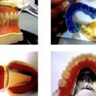 Business 2 image AYMANS 1 HOUR DENTURE REPAIRS Dental Technicians in Birmingham We
