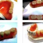 Business 1 image AYMANS 1 HOUR DENTURE REPAIRS Dental Technicians in Birmingham We