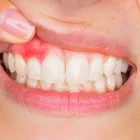 Business 3 image BRAMCOTE DENTAL CLINIC Orthodontists in Stockport Ch