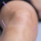 Business 5 image CATHEDRAL PHYSIOTHERAPY Physiotherapists in Exeter De