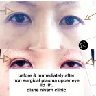 Business 1 image DIANE NIVERN CLINIC LTD Skin Care Clinics in Whitefield Gr