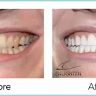 Business 5 image GLEN DENTAL Prosthodontists, Endodontists & Periodontists in Leicester Le