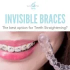 Business 10 image GLEN DENTAL Prosthodontists, Endodontists & Periodontists in Leicester Le