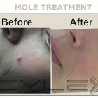 Business 4 image INSKIN GROUP LTD Tattoo Artists in Altrincham Ch