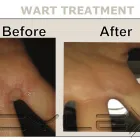 Business 5 image INSKIN GROUP LTD Tattoo Artists in Altrincham Ch