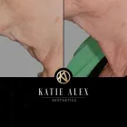 Business 1 image KATIE ALEX AESTHETICS Private Clinics in Altrincham Ch