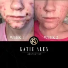 Business 2 image KATIE ALEX AESTHETICS Private Clinics in Altrincham Ch