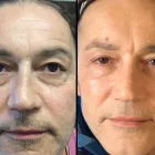 Business 5 image KATIE ALEX AESTHETICS Private Clinics in Altrincham Ch