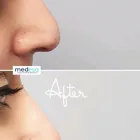 Business 5 image MEDESQ AESTHETICS Plastic & Cosmetic Surgery in Stourbridge We