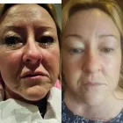 Business 5 image NON SURGICAL BEAUTY Skin Care Clinics in SALE Ch