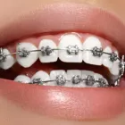 Business 5 image ORTHODONTICS FOR YOU Dermal Filler Treatment in Solihull We