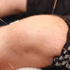 Business 4 image PHYSIO FORM Sports Injury Clinics in Burton-On-Trent St