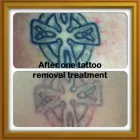 Business 1 image SEMI PERMANENT MAKEUP BY EMMA Beauty Salons & Consultants in Redcar Cl