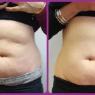 Business 1 image SLENDERWAVE Slimming Products & Services in Tonbridge Ke