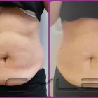 Business 2 image SLENDERWAVE Slimming Products & Services in Tonbridge Ke