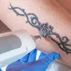 Business 3 image THE SUFFOLK LASER & AESTHETIC CLINIC Tattoo Removal Service in Haverhill Su