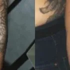 Business 2 image THE TATTOO REMOVAL EXPERTS (CHISWICK) Tattoo Removal Service in London Gr