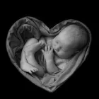 Business 9 image TOLAND PHOTOGRAPHY LTD Wedding Services in Stoke-On-Trent Sts