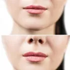 Business 6 image UNISKIN AESTHETICS Skin Care Clinics in Belper De