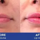 Business 8 image VICKI WARD Skin Care Clinics in Warwick Wa