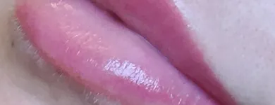 Business 3 image ESSJAY Skin Care Clinics in Doncaster So